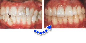 �O���̃��W���[�U