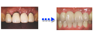 �I�[���Z���~�b�N