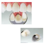 �n�C�u���b�h