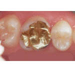 �S�[���h�i�����j