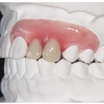 �\�t�g�f���`���[