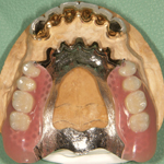 �~�����O�f���`���[