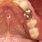 �n�o�`�f���`���[