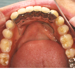 �R�[�k�X�f���`���[