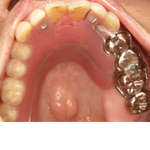 �����A�^�b�`�����g