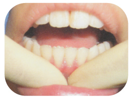 �������̃}�b�T�[�W