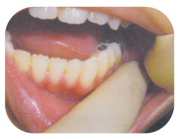 �������̃c�{