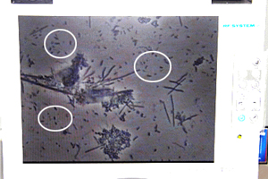 �ʑ����������Ō����׋ۂ̉摜